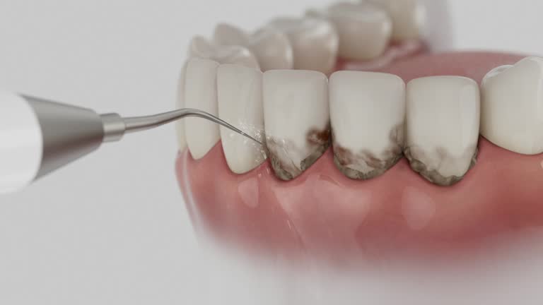Reliable Dental Implants contractor in Sargent, TX by Smile Center Dentistry